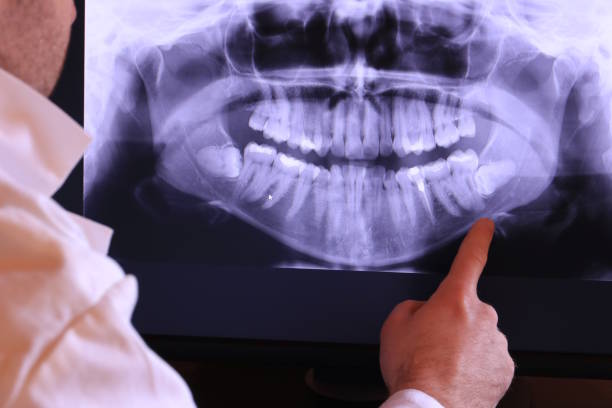 Best Emergency Dental Surgery in Mocksville, NC